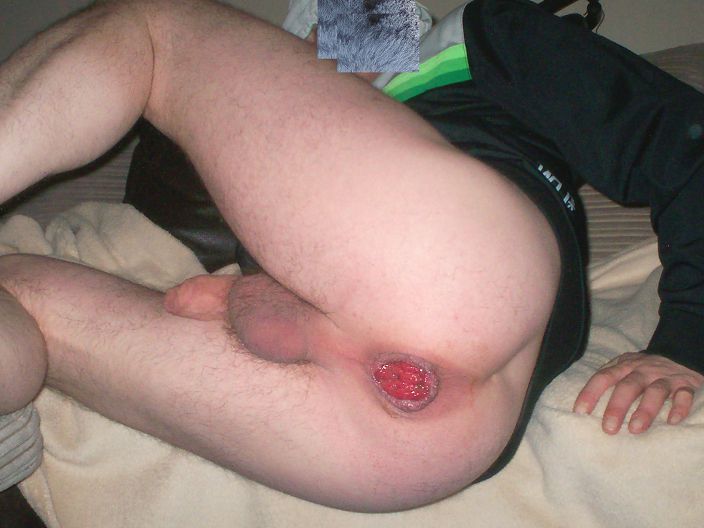bum ass butt man hole anal pics