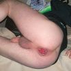 bum ass butt man hole anal pics