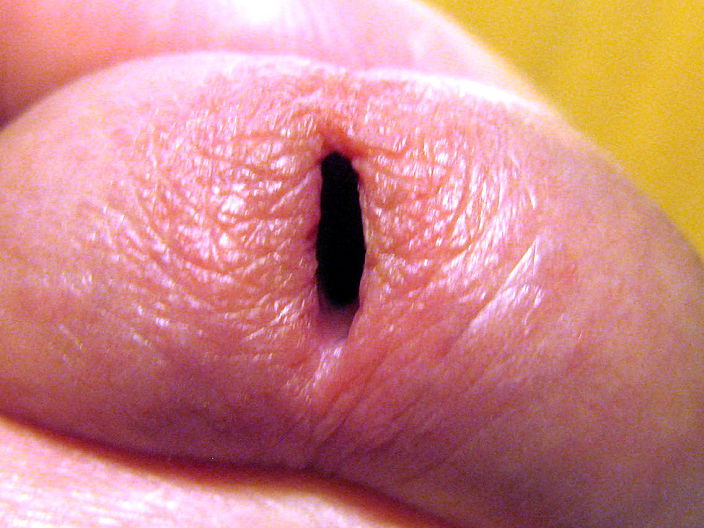 Раз ... раз ...