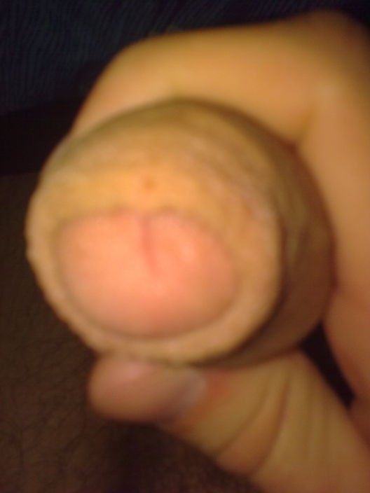 First photo