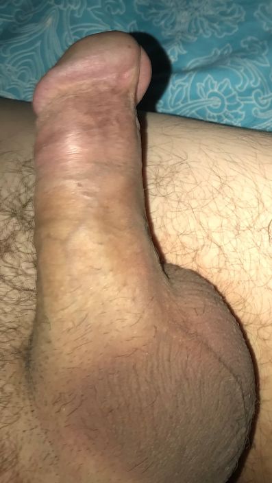 my dick_01