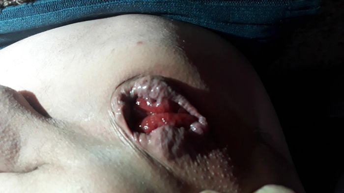 пробочка большая на месте)