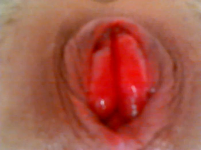 После помпы